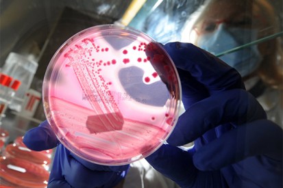 Antibiotic resistant E. coli is causing major problems for  medical researchers. Photo: Getty