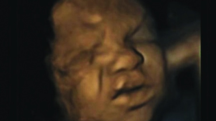 smoking pregnant babies