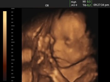 kids2-050415-newdaily