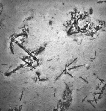 An anchor can be seen in the sonar image from shipwreck, during the search for missing MH370.