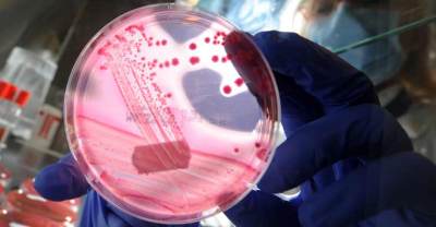 Antibiotic resistant superbugs have killed 18 people in Australia. Picture: Getty Images.