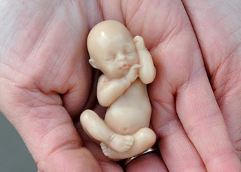 Anti-abortion groups are strongly opposed to decriminalisation. Photo: Getty