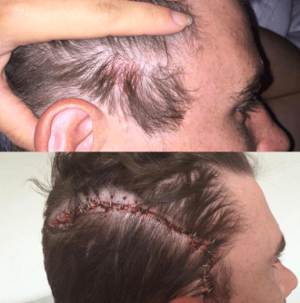 The Bachelorette star posted this grisly warning on Instagram. Photo: Instagram