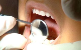Labor attacks Liberal dental plan
