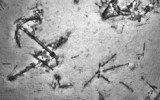 An anchor can be seen in the sonar image from shipwreck, during the search for missing MH370.