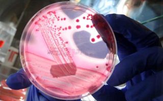 Antibiotic resistant superbugs have killed 18 people in Australia.