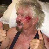 Richard Branson bicycle crash