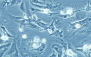 3D printer produces heart stem cells