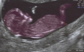 Mothers may soon have extensive genetic data about their unborn child.