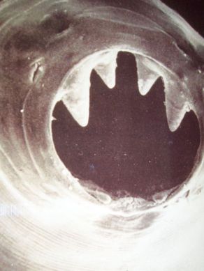 A hookworm's teeth and mouth are used to burrow into the host.