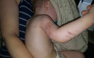 Toddler saved from python