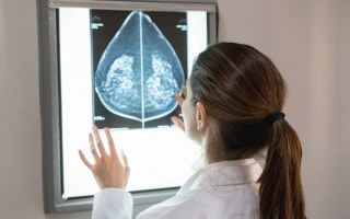 breast cancer scan