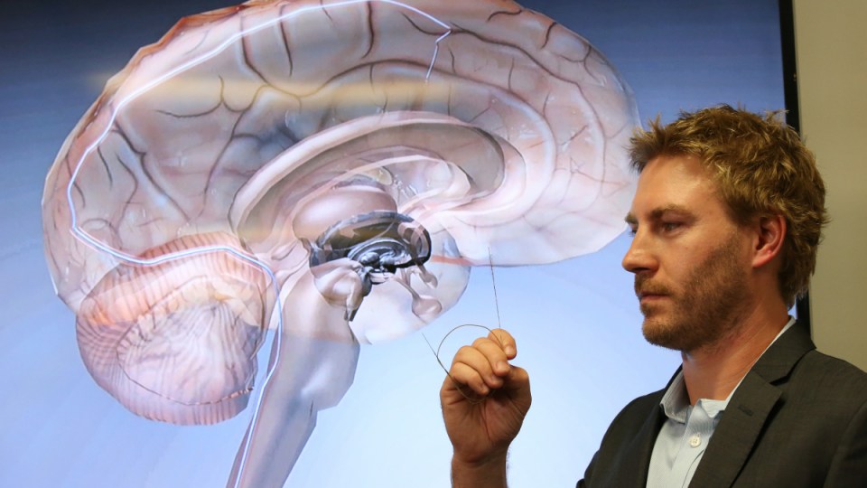brain implant paralysed